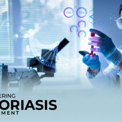 XEMSIS | Revolutionizing Psoriasis Treatment for a Clearer Future