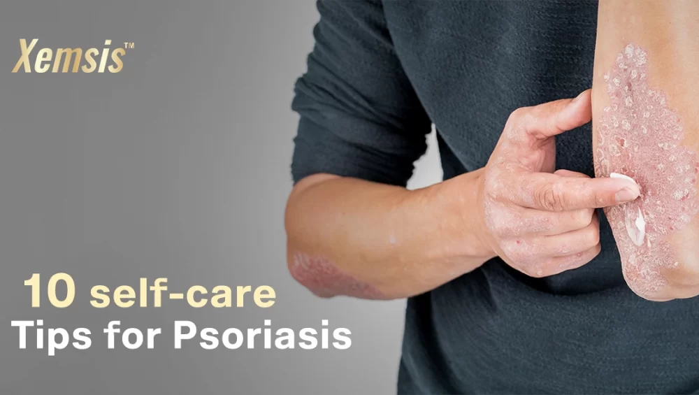 10 self-care tips for psoriasis