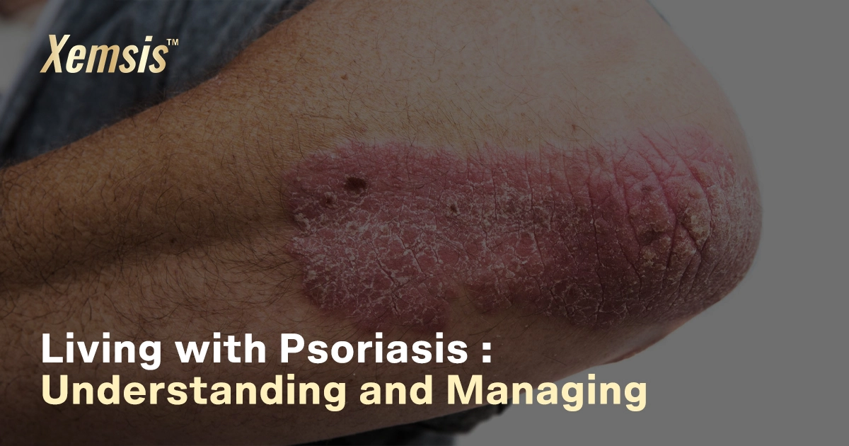 Living With Psoriasis